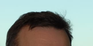 WELSH TECH FIRM AWARDED CONTRACT TO TACKLE LONELINESS IN MONMOUTHSHIRE Dr Ian Wiles Medical Director