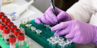 LGA RESPONDS TO LATEST TEST AND TRACE FIGURES laboratory 3827745 1920