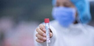 Keep to the guidelines after receiving the COVID-19 vaccine covid tester holding a vial 940 x 628