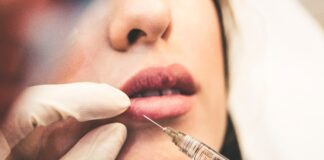 Love Island 2021 sparks jump in searches for ‘lip filler’ and ‘weight loss products Primed Pharmacy Love Island scaled