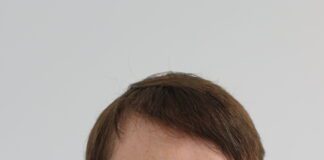 What to do if your business has been hacked Anthony Green CTO FoxTech 1 1 scaled