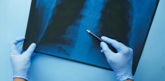 The Four Key Elements of Medical Negligence, and Their Importance to Your Case pexels towfiqu barbhuiya 8395815 scaled