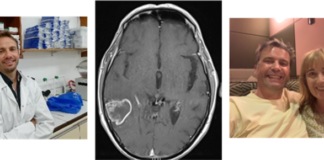 Super sponge’ innovation brings treatment hope to brain cancer patients image007