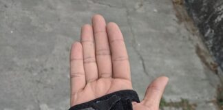 Arthritis Expert…these are the eight best foods to alleviate symptoms hand 6003626 640