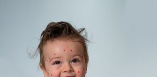 Who Should Consider Getting the Chickenpox Vaccine? boy 6556582 640