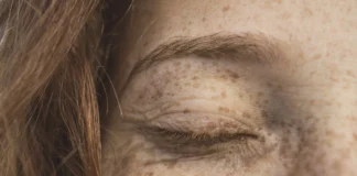 Five Ways To Combat Wrinkles Without Using Botox beauty wrinkles freckles