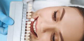 Are Porcelain Veneers Good for Your Teeth? 5340 wp