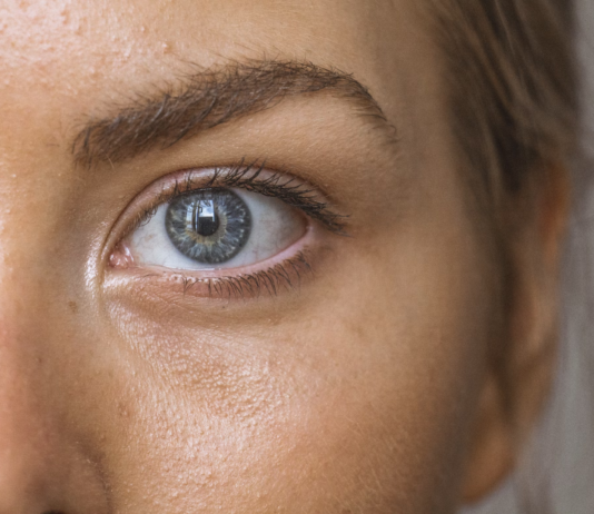 WARNING: These 5 Blackhead Removal Mistakes Are Wrecking Your Skin According to a Skincare Expert unnamed