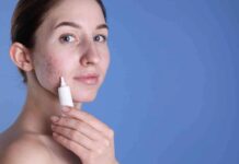 Achieving luminous skin: a holistic approach to imperfection-free radiance youngwomanwithacneproblemapplyingcosmeticproductontoherskin wp