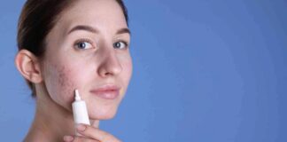 Achieving luminous skin: a holistic approach to imperfection-free radiance youngwomanwithacneproblemapplyingcosmeticproductontoherskin wp