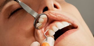 The benefits of private dental care: What makes it different caroline lm 8BkF0sTC6Uo unsplash